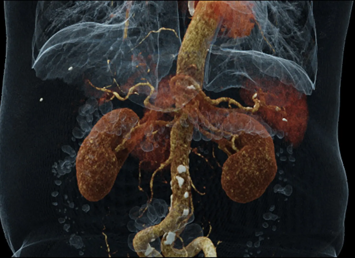 Bauchultraschall Abdomensonografie