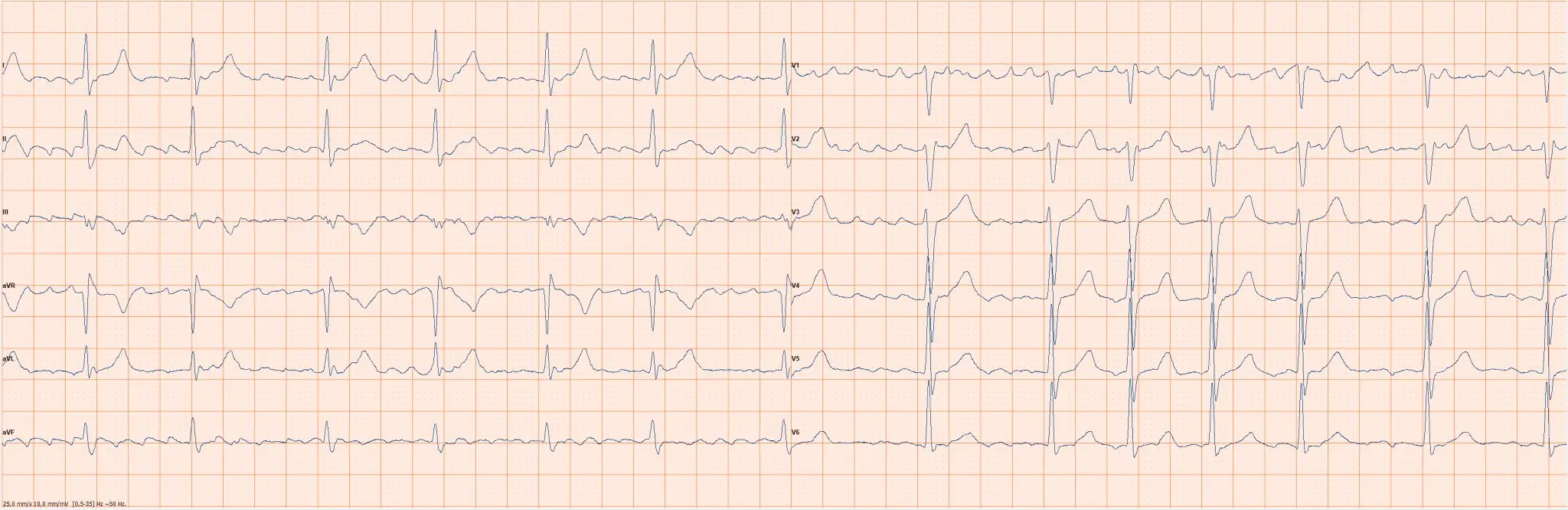 Ruhe-EKG Untersuchung